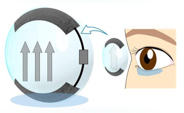 An illustration of the soft contact lens design. IMAGE CREDIT: Tohoku University.