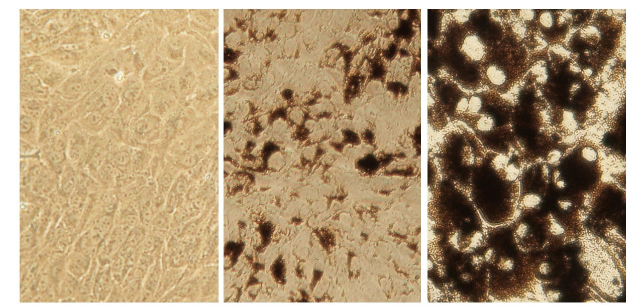The repigmentation of RPE Cells. Image credit: Mika Reinisalo