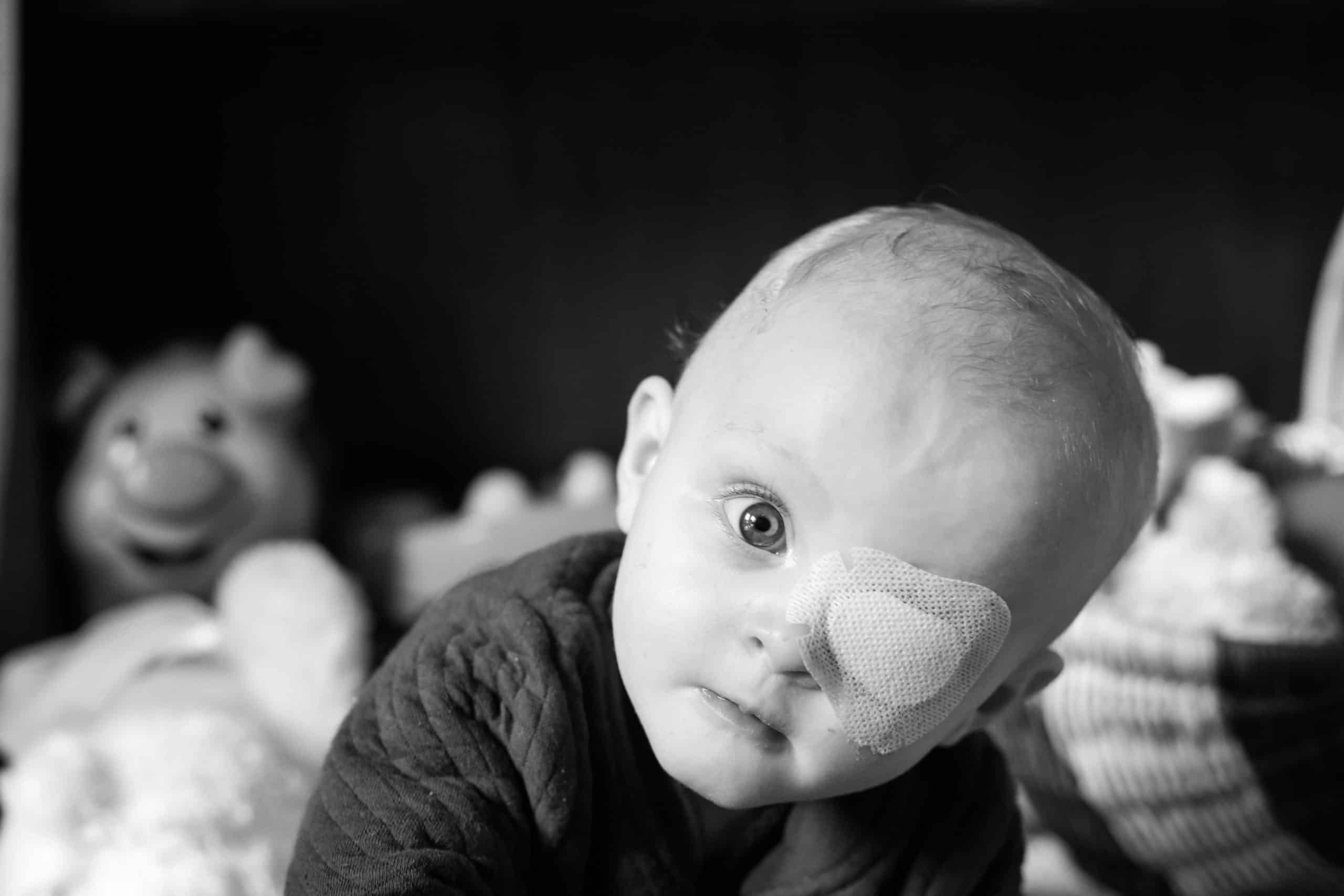 Cataract Kids Australia
