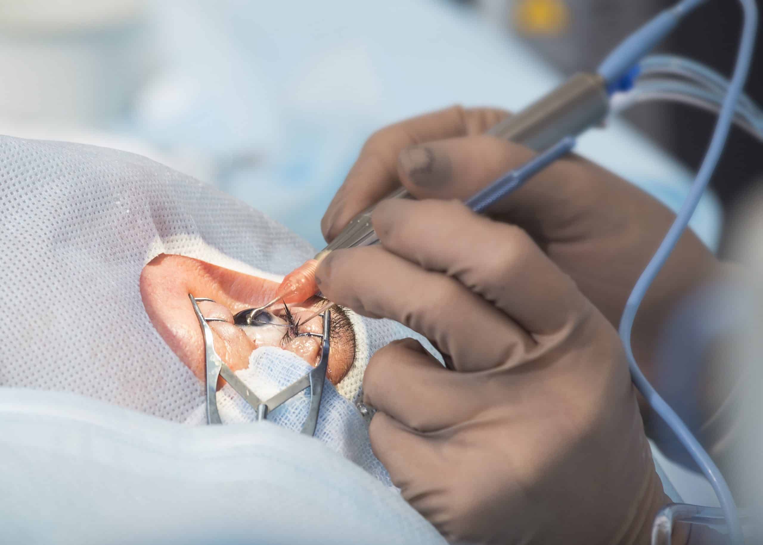 The first eight Rapid Access Hubs for procedures including cataract surgery will be established in the next year.