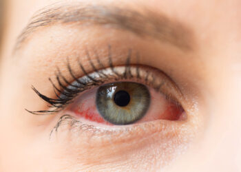 Dry eye disease affects more than 4 million Australians and it's on the rise. Image: sruilk/Shutterstock.com.