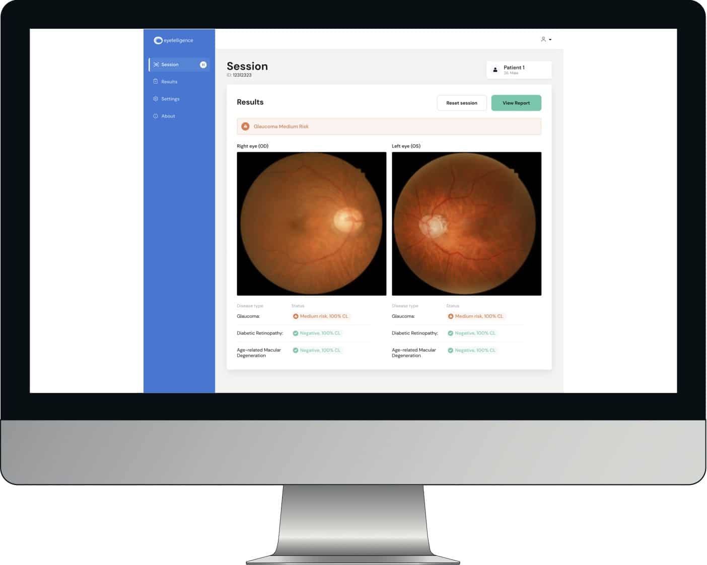 Eyetelligence system AI