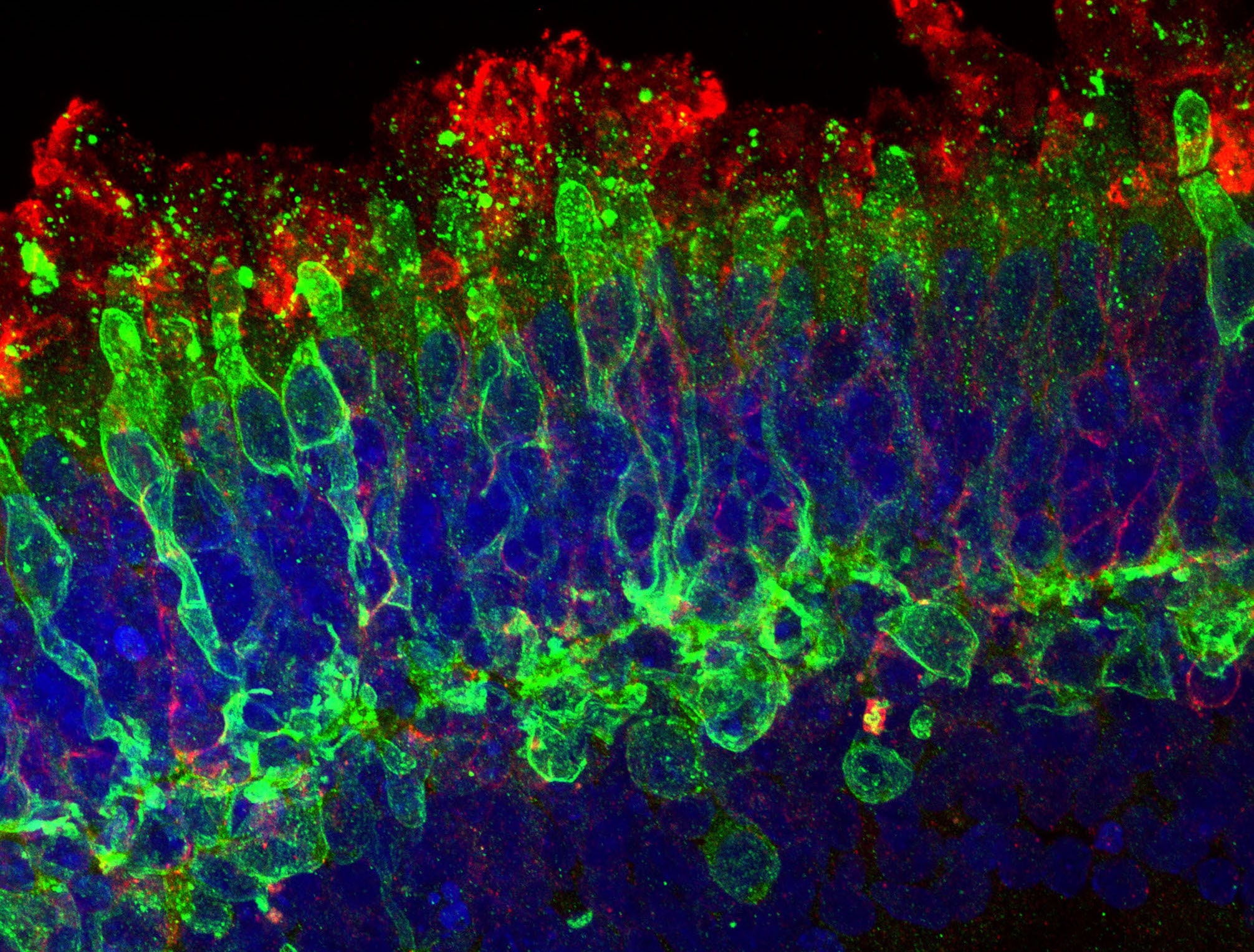 Figure 3: A retinal organoid used for functional genomic investigations for variant classification. Image: Prof Robyn Jamieson.