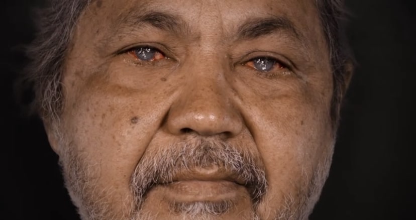 The West Australian Trachoma Storybook