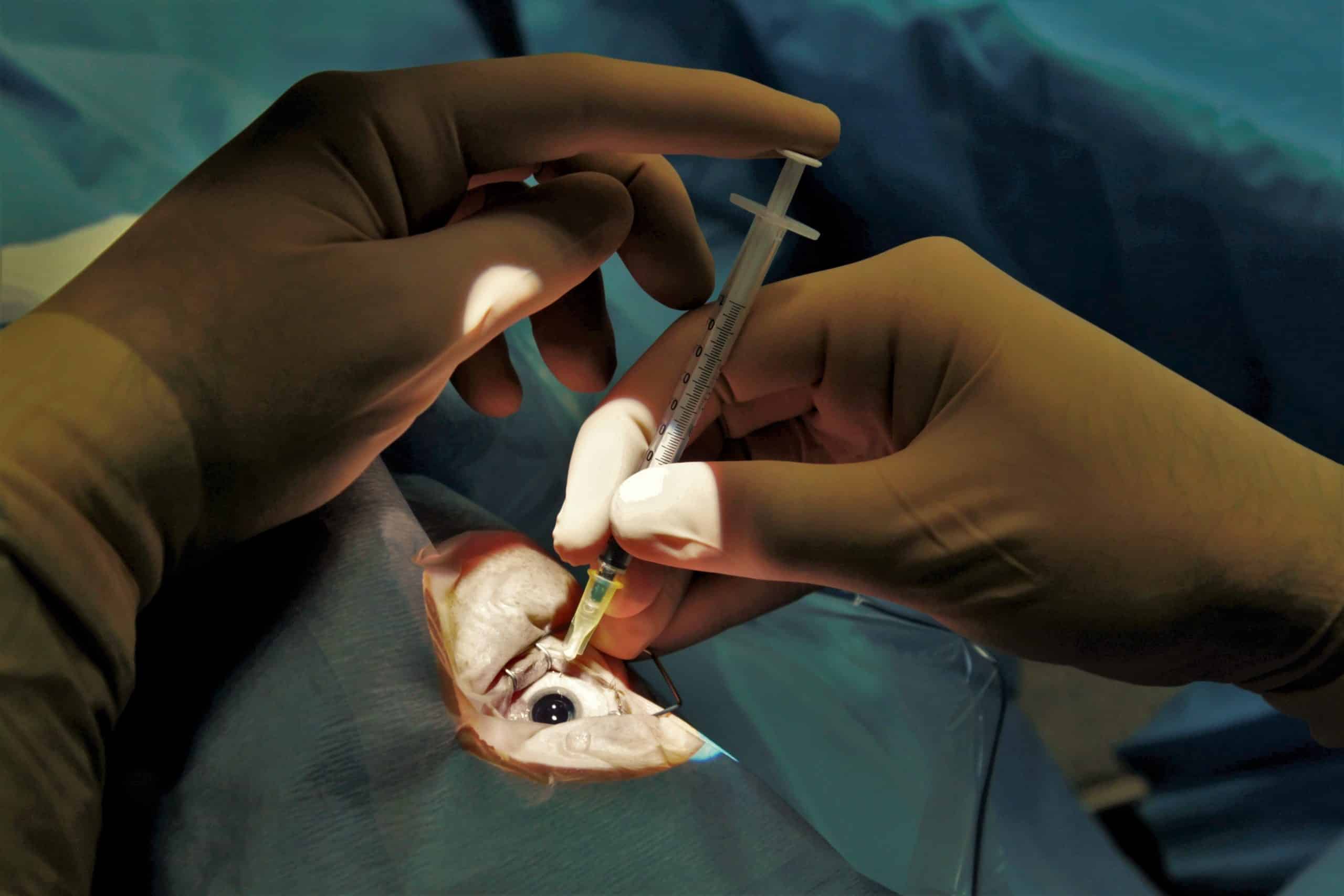 Two contentious proposals related to intravitreal injections have remained in the final report.