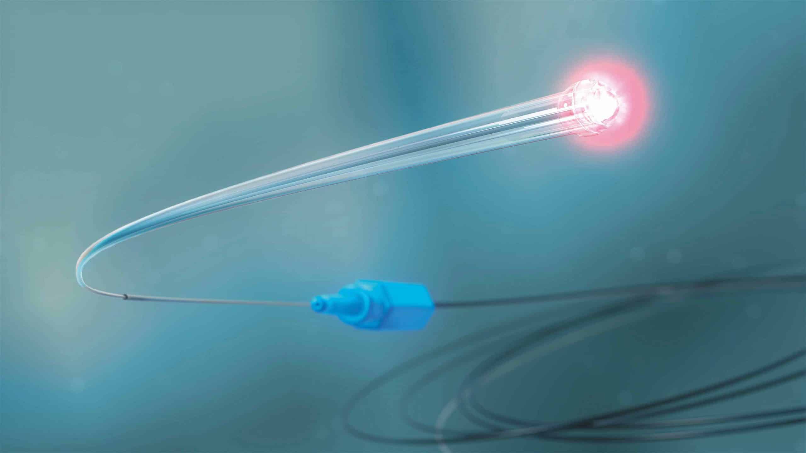 At 250 microns, iTrack comprises an infusion pathway for the delivery of OVD, a fiber optic and a guide wire.