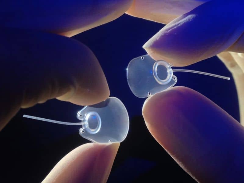 The Molteno3 SL(left) and SS glaucoma implants. Image: Molteno Ophthalmic.