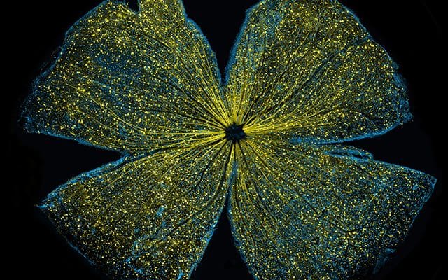 Confocal microscope image of mouse retina sparkling with fluorescent molecules. Image courtesy of Keunyoung Kim, Wonkyu Ju and Mark Ellisman, all of the National Center for Microscopy and Imaging Research at UC San Diego.