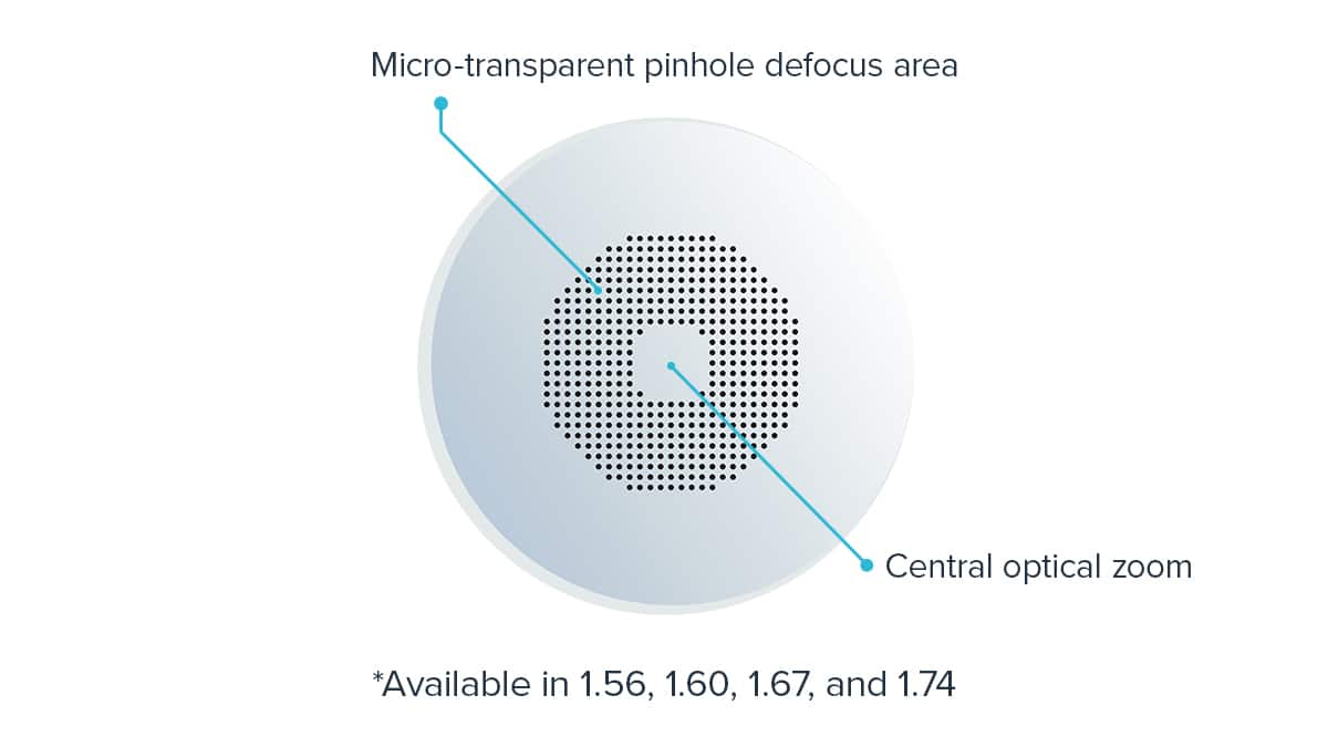 The MyoEase lens is designed with a mid-peripheral ring of high-precision, micro-transparent pinholes.