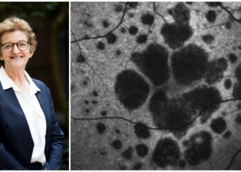 Prof Robyn Guymer says there's one main reason GA therapies aren't yet approved in Europe. Images: CERA.