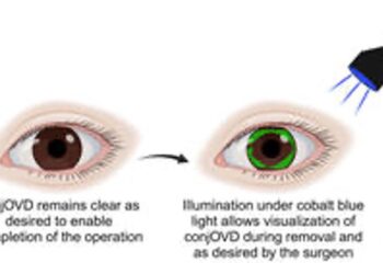 A graphic shows how the eye gel works. Image: Wilmer Eye Institute.