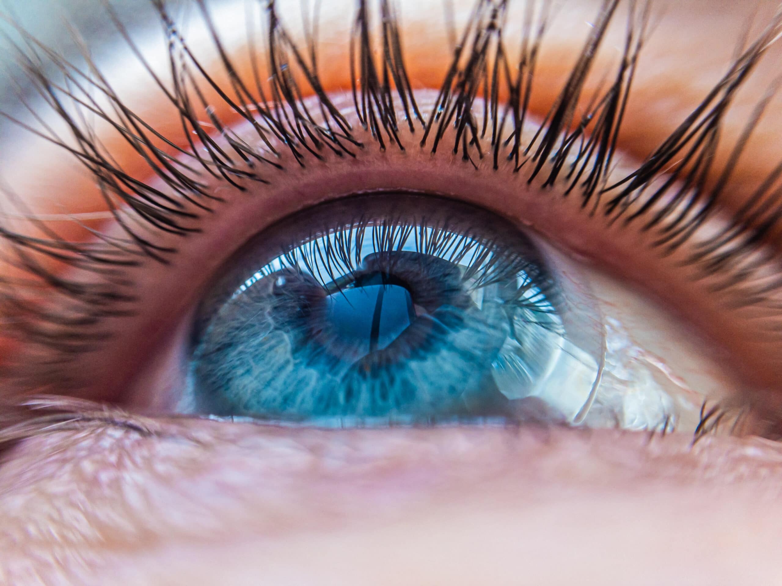 Attendees will also learn about the various contact lens attributes contributing to discomfort.