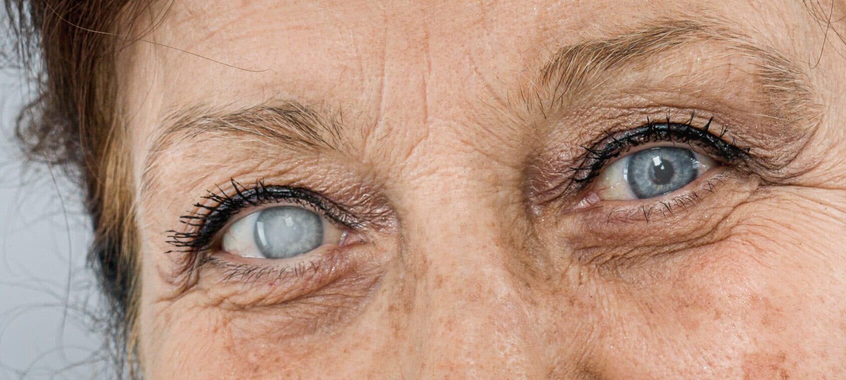 A drug compound showed an improvement in refractive index profiles in 61% of cataract lenses in mice.
