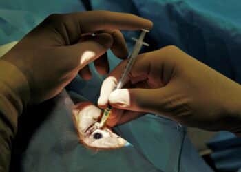 Robot radiotherapy
