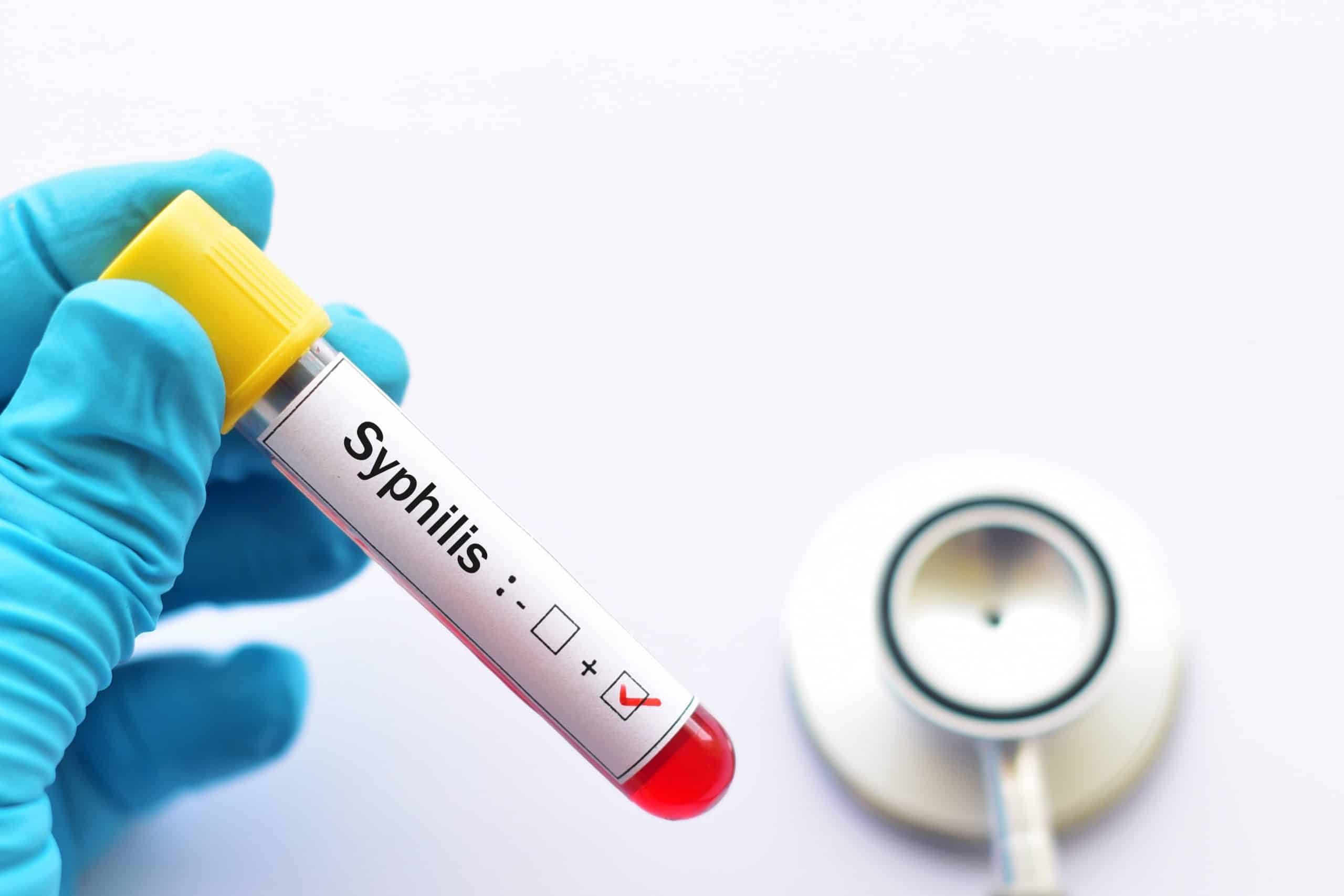 There's been a 45% increase in notified syphilis cases from 950 cases in 2015 to 1,375 cases in 2018 in Victoria.