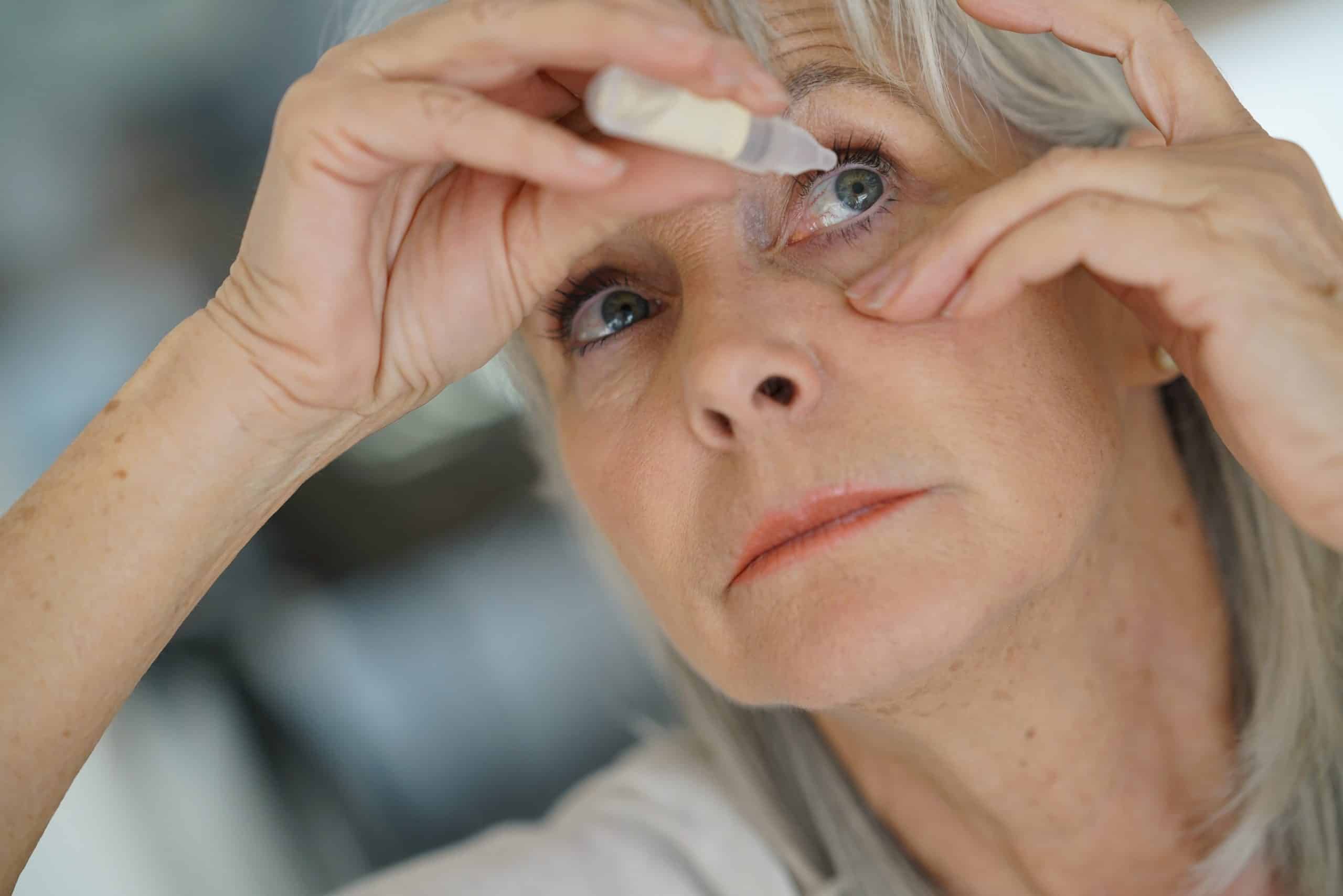 Difficulty instilling eye drops and forgetfulness are common reasons for poor glaucoma treatment compliance.
