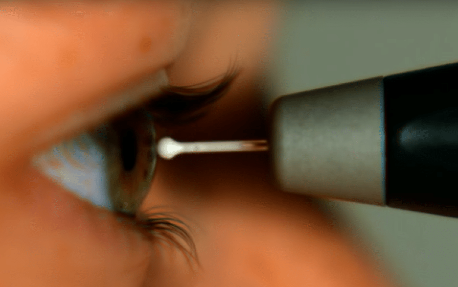 Tonometry with single-use probe recommended as the safest modality for IOP measurement.
