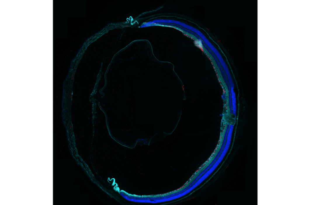 TrkB expression in the eye following gene therapy. Image: Andy Osborne, Head of Biology at Ikarovec Limited.